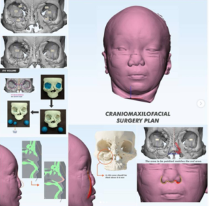 Craniomaxillofacial-1